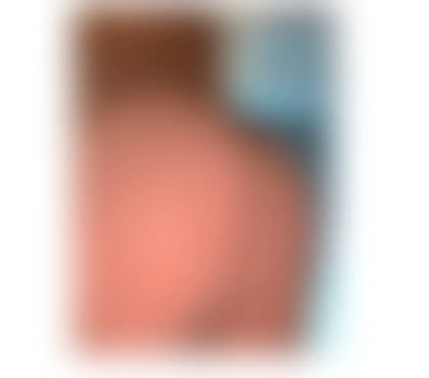 Escorts Dalston, England ✨BIG juicy ass available🍑for hungry TOPs